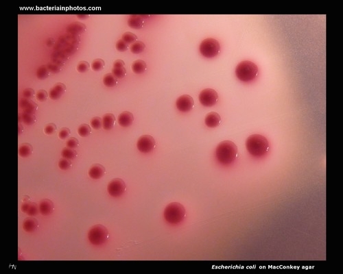 escherichia coli colonies on MacConkey agar